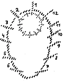 170-18